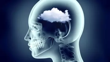 x-ray image of person’s clouded brain